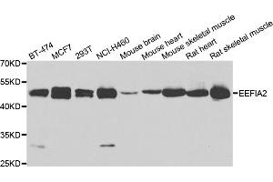 Western blot analysis of extracts of various cell lines, using EEF1A2 antibody (ABIN4903541) at 1:1000 dilution. (EEF1A2 Antikörper)