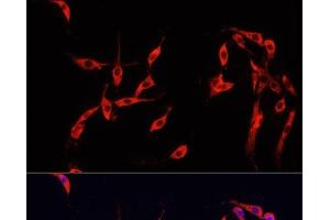 Immunofluorescence analysis of PC-12 cells using SMAD2 Polyclonal Antibody at dilution of 1:100. (SMAD2 Antikörper)