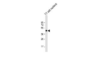 NKX2-1 Antikörper  (N-Term)