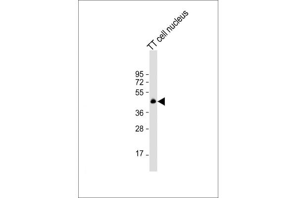 NKX2-1 Antikörper  (N-Term)