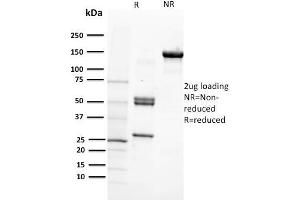 SDS-PAGE Analysis Purified CD29 Mouse Monoclonal Antibody (12G10). (ITGB1 Antikörper)