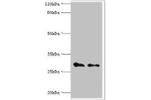 Western blot All lanes: COP9 signalosome complex subunit 7a antibody at 4 μg/mL Lane 1: Rat heart tissue Lane 2: Rat brain tissue Secondary Goat polyclonal to rabbit IgG at 1/10000 dilution Predicted band size: 30 kDa Observed band size: 30 kDa (COPS7A Antikörper  (AA 1-275))