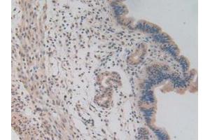 IHC-P analysis of Mouse Uterus Tissue, with DAB staining. (NUP85 Antikörper  (AA 418-653))