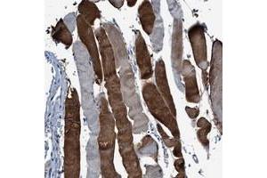 Immunohistochemical staining of human skeletal muscle with RWDD2B polyclonal antibody  shows strong cytoplasmic positivity in a heterogeneous staining pattern. (RWDD2B Antikörper)