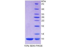 SDS-PAGE (SDS) image for S100 Calcium Binding Protein A7 (S100A7) (AA 1-101) protein (His tag) (ABIN1099442)