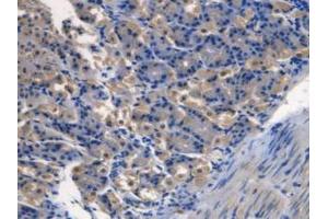 IHC-P analysis of Mouse Stomach Tissue, with DAB staining. (TMEM27 Antikörper  (Leu222))