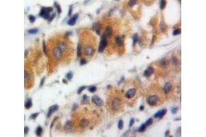 Used in DAB staining on fromalin fixed paraffin-embedded Stomach tissue (MUC5B Antikörper  (AA 5366-5444))