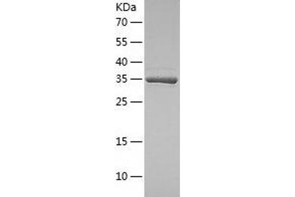 DERA Protein (AA 1-318) (His tag)