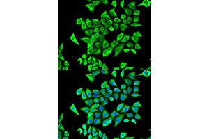 Immunofluorescence analysis of A549 cell using LCN2 antibody. (Lipocalin 2 Antikörper  (AA 21-198))