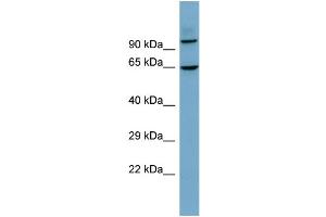 Host:  Rabbit  Target Name:  GALNTL6  Sample Type:  THP-1 Whole cell lysates  Antibody Dilution:  1.