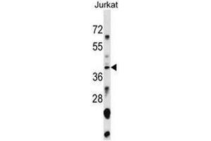 anti-Small Nuclear RNA Activating Complex, Polypeptide 1, 43kDa (SNAPC1) (AA 138-168), (Middle Region) antibody
