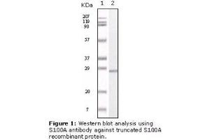 Image no. 2 for anti-S100 Calcium Binding Protein A1 (S100A1) antibody (ABIN232125) (S100A1 Antikörper)