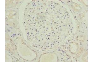 Immunohistochemistry of paraffin-embedded human kidney tissue using ABIN7175021 at dilution of 1:100 (C5orf24 Antikörper  (AA 7-188))