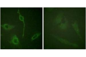 Immunofluorescence analysis of HeLa cells, using PDGFR alpha (Ab-762) Antibody. (PDGFRA Antikörper  (AA 731-780))