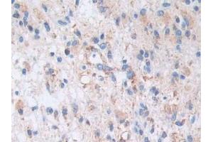 Immunohistochemistry (IHC) image for anti-A Kinase (PRKA) Anchor Protein 11 (AKAP11) (AA 1650-1901) antibody (ABIN7443557)