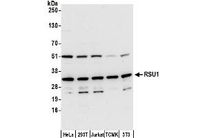 Western Blotting (WB) image for anti-Ras Suppressor Protein 1 (RSU1) (AA 227-277) antibody (ABIN7450700)