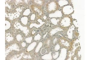 ABIN6256278 and ABIN6267225 at 1/100 staining human normal kidney tissue by IHC-P.