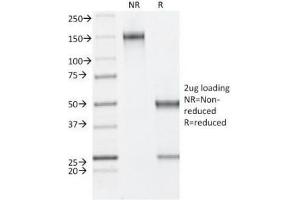 SDS-PAGE Analysis of Purified, BSA-Free Estrogen Receptor beta Antibody (clone ESR2/686). (ESR2 Antikörper  (C-Term))