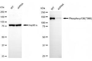 Western blotting analysis using phospho-p130 (T986) antibody (ABIN7799666).