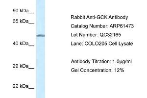 Western Blotting (WB) image for anti-Glucokinase (Hexokinase 4) (GCK) (N-Term) antibody (ABIN2788816)