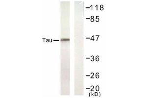 Image no. 1 for anti-Microtubule-Associated Protein tau (MAPT) (Ser422) antibody (ABIN197528) (MAPT Antikörper  (Ser422))