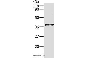 Western blot analysis of Hela cell, using AKR1B1 Polyclonal Antibody at dilution of 1:340 (AKR1B1 Antikörper)