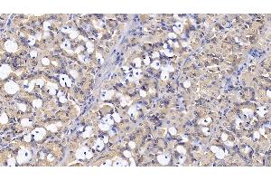 Immunohistochemistry (IHC) image for anti-Interleukin 1 Receptor Antagonist (IL1RN) (AA 26-177) antibody (ABIN7425773)