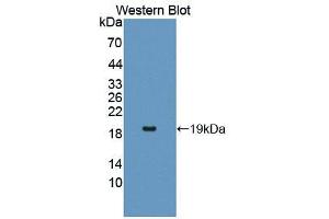 Western blot analysis of the recombinant protein. (IL17RA Antikörper  (AA 377-534))