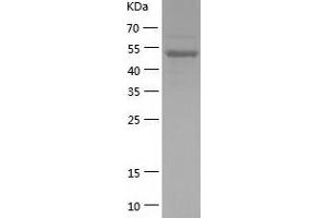 L3MBTL2 Protein (AA 178-625) (His tag)