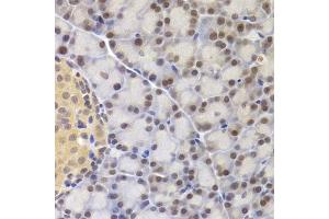 Immunohistochemistry of paraffin-embedded rat pancreas using MCM4 Antibody (ABIN5971548) at dilution of 1/200 (40x lens). (MCM4 Antikörper)