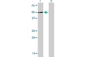 Western Blotting (WB) image for anti-Lymphoid Enhancer-Binding Factor 1 (LEF1) (AA 1-399) antibody (ABIN565556)