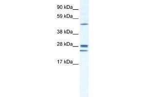GJB2 antibody used at 1. (GJB2 Antikörper  (N-Term))
