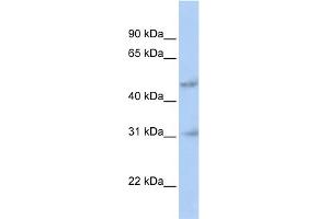 WB Suggested Anti-ABT1 Antibody Titration:  0.