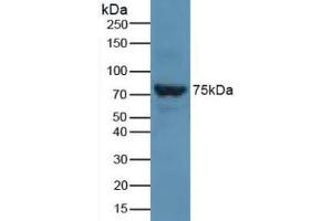 Detection of SLC27A5 in Rat Liver Tissue using Polyclonal Antibody to Solute Carrier Family 27 Member 5 (SLC27A5) (SLC27A5 Antikörper  (AA 488-690))