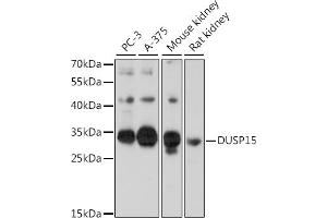 Western blot analysis of extracts of various cell lines, using DUSP15 antibody (ABIN7266846) at 1:1000 dilution. (DUSP15 Antikörper  (AA 10-90))