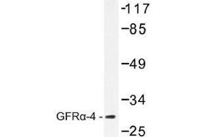 Image no. 1 for anti-GDNF Family Receptor alpha 4 (GFRA4) antibody (ABIN317910) (GFRA4 Antikörper)