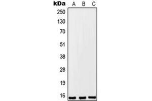 Western blot analysis of FKSG2 expression in A549 (A), Raw264. (FKSG2 Antikörper  (Center))