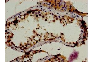 Immunohistochemistry of paraffin-embedded human testis tissue using ABIN7167841 at dilution of 1:100 (RBP1 Antikörper  (AA 70-112))