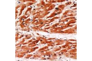 Immunohistochemical analysis of MYBPC3 staining in human heart formalin fixed paraffin embedded tissue section.