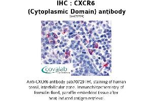 Image no. 1 for anti-Chemokine (C-X-C Motif) Receptor 6 (CXCR6) (2nd Cytoplasmic Domain) antibody (ABIN1733413) (CXCR6 Antikörper  (2nd Cytoplasmic Domain))