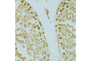 Immunohistochemistry of paraffin-embedded rat testis using RCC1 antibody (ABIN5973761) at dilution of 1/100 (40x lens). (RCC1 Antikörper)
