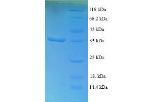 SDS-PAGE (SDS) image for Eukaryotic Translation Elongation Factor 1 delta (Guanine Nucleotide Exchange Protein) (EEF1D) (AA 2-281) protein (His tag) (ABIN5709433) (EEF1D Protein (AA 2-281) (His tag))