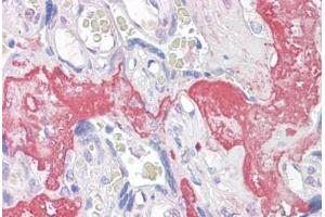 Anti-GAGED2 antibody IHC staining of human placenta. (XAGE1D Antikörper  (AA 58-69))