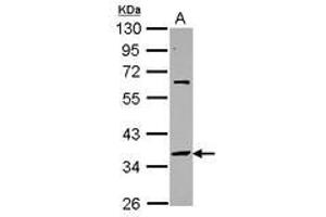Image no. 1 for anti-Small Nuclear RNA Activating Complex, Polypeptide 2, 45kDa (SNAPC2) (AA 60-290) antibody (ABIN1501022) (SNAPC2 Antikörper  (AA 60-290))