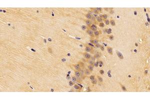 Immunohistochemistry (IHC) image for anti-Bone Morphogenetic Protein 2 (BMP2) (AA 49-243) antibody (ABIN7430396)