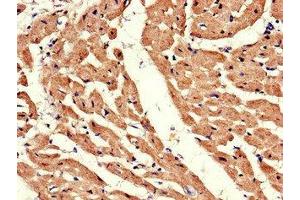 Immunohistochemistry of paraffin-embedded human heart tissue using ABIN7145355 at dilution of 1:100 (ADRB1 Antikörper  (AA 401-477))