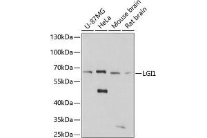 Western blot analysis of extracts of various cell lines, using LGI1 antibody (ABIN7268237) at 1:3000 dilution. (LGI1 Antikörper  (AA 301-557))