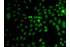 Immunofluorescence analysis of A549 cells using TRPS1 antibody (ABIN5974943).