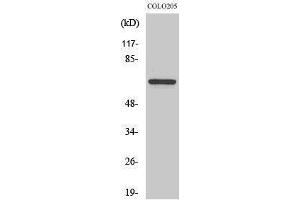 Western Blotting (WB) image for anti-Forkhead Box O4 (FOXO4) (Ser91) antibody (ABIN3175138) (FOXO4 Antikörper  (Ser91))