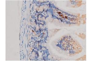 ABIN6267463 at 1/200 staining Mouse intestinal tissue sections by IHC-P.